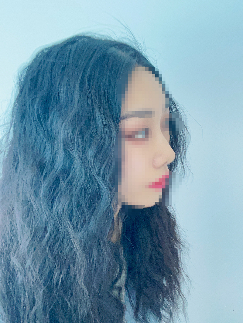 수술후기이미지