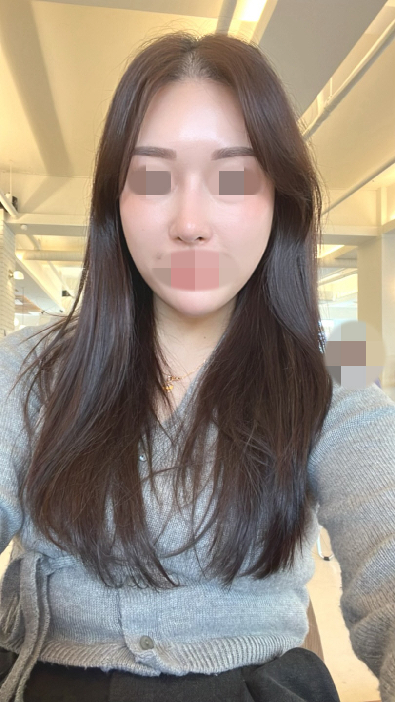 수술후기이미지