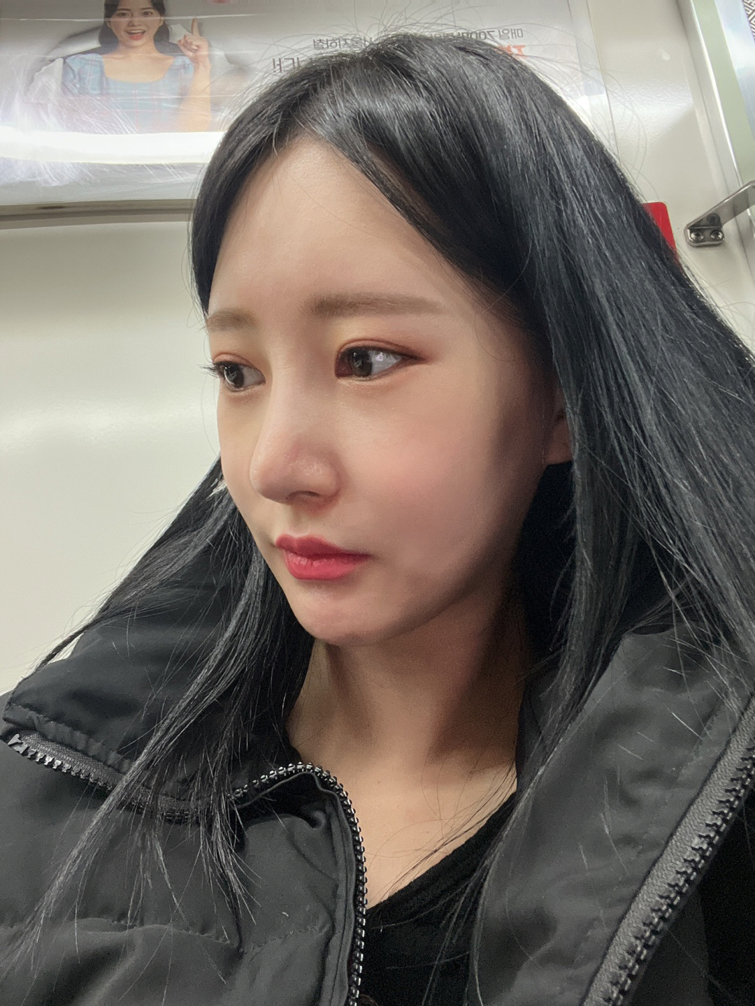 수술후기이미지