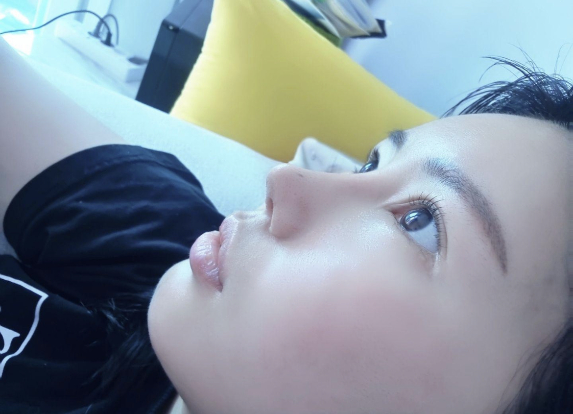 수술후기이미지