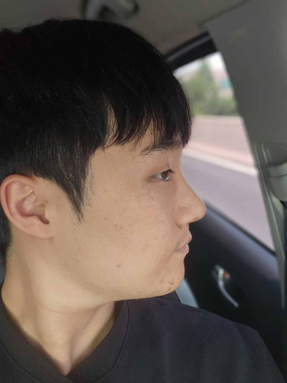 수술후기이미지