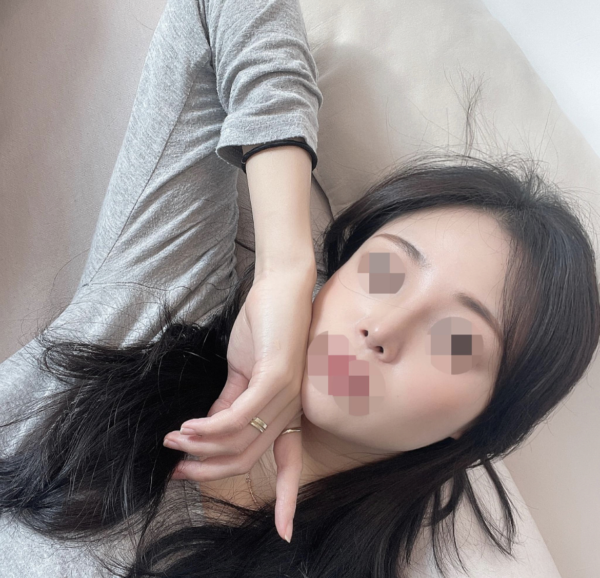 수술후기이미지