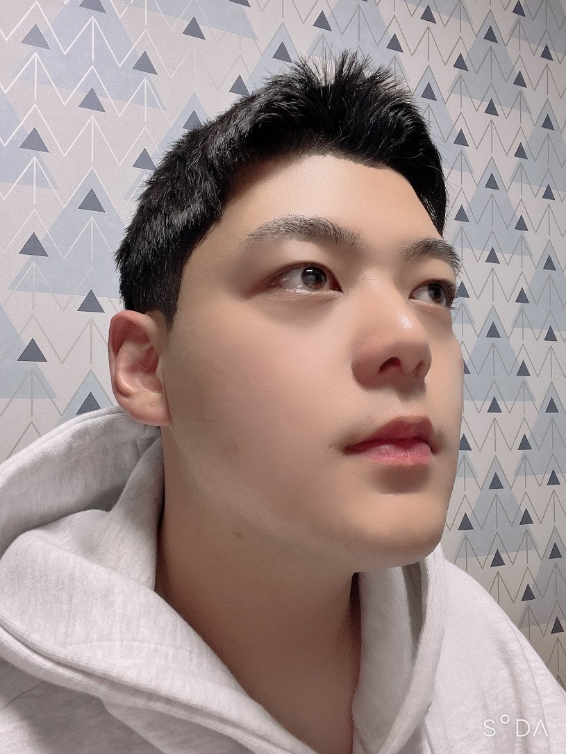 수술후기이미지