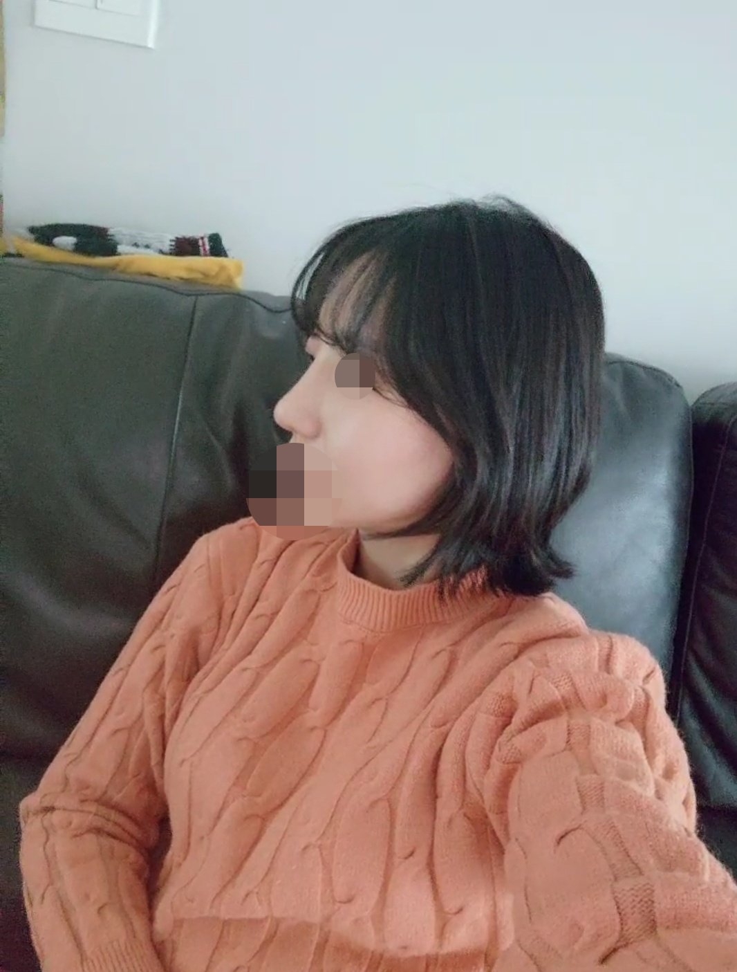 수술후기이미지