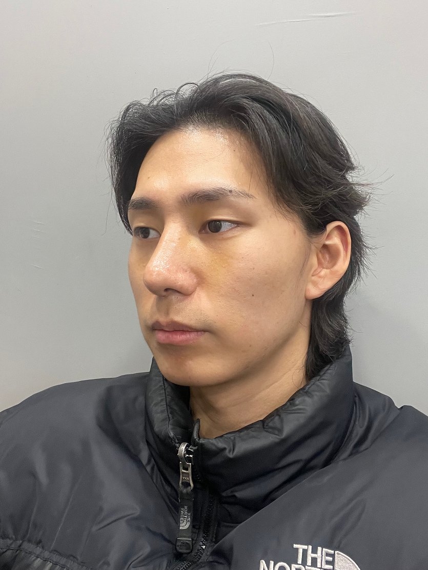 수술후기이미지