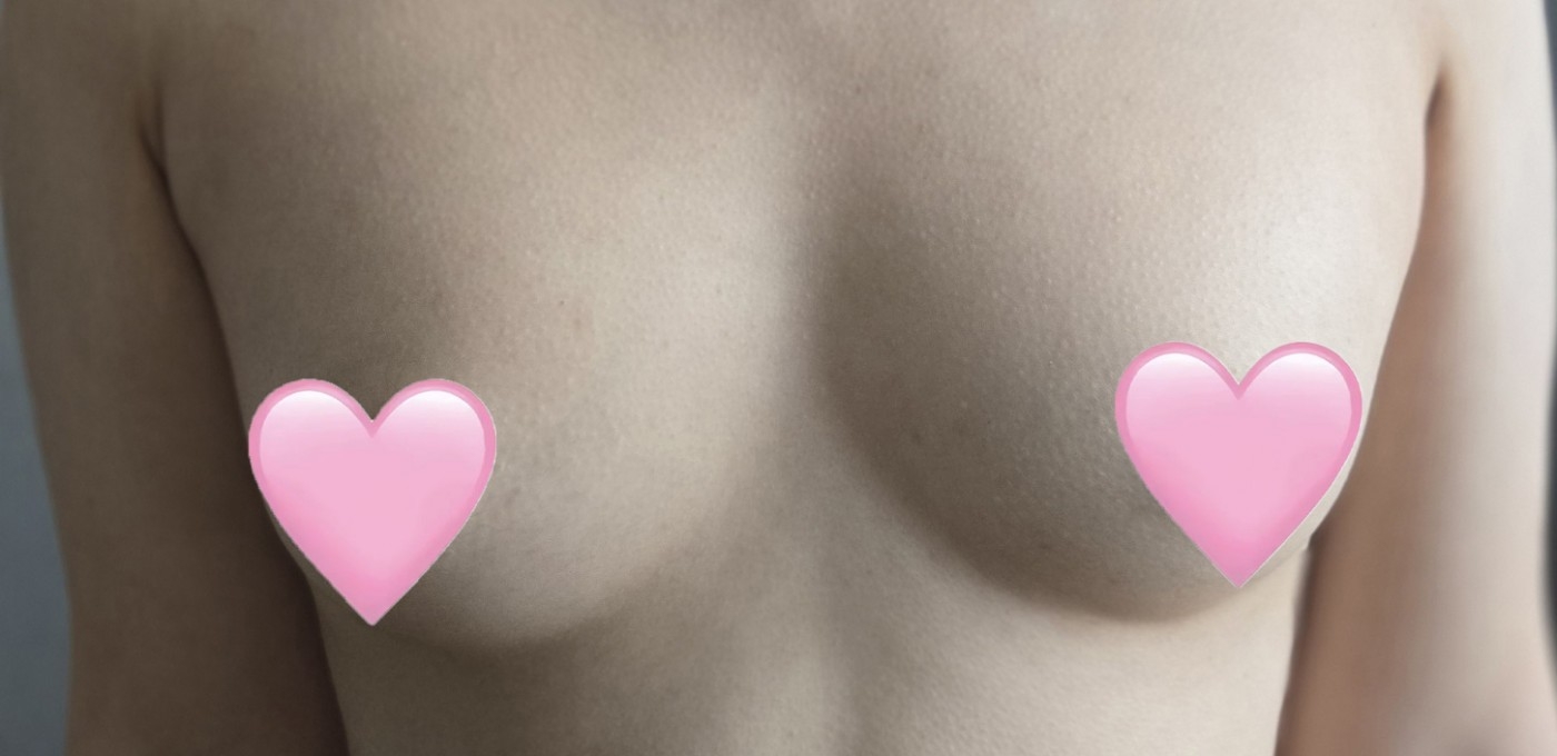 수술후기이미지