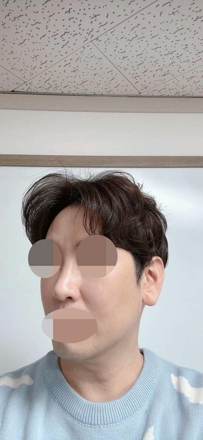 수술후기이미지