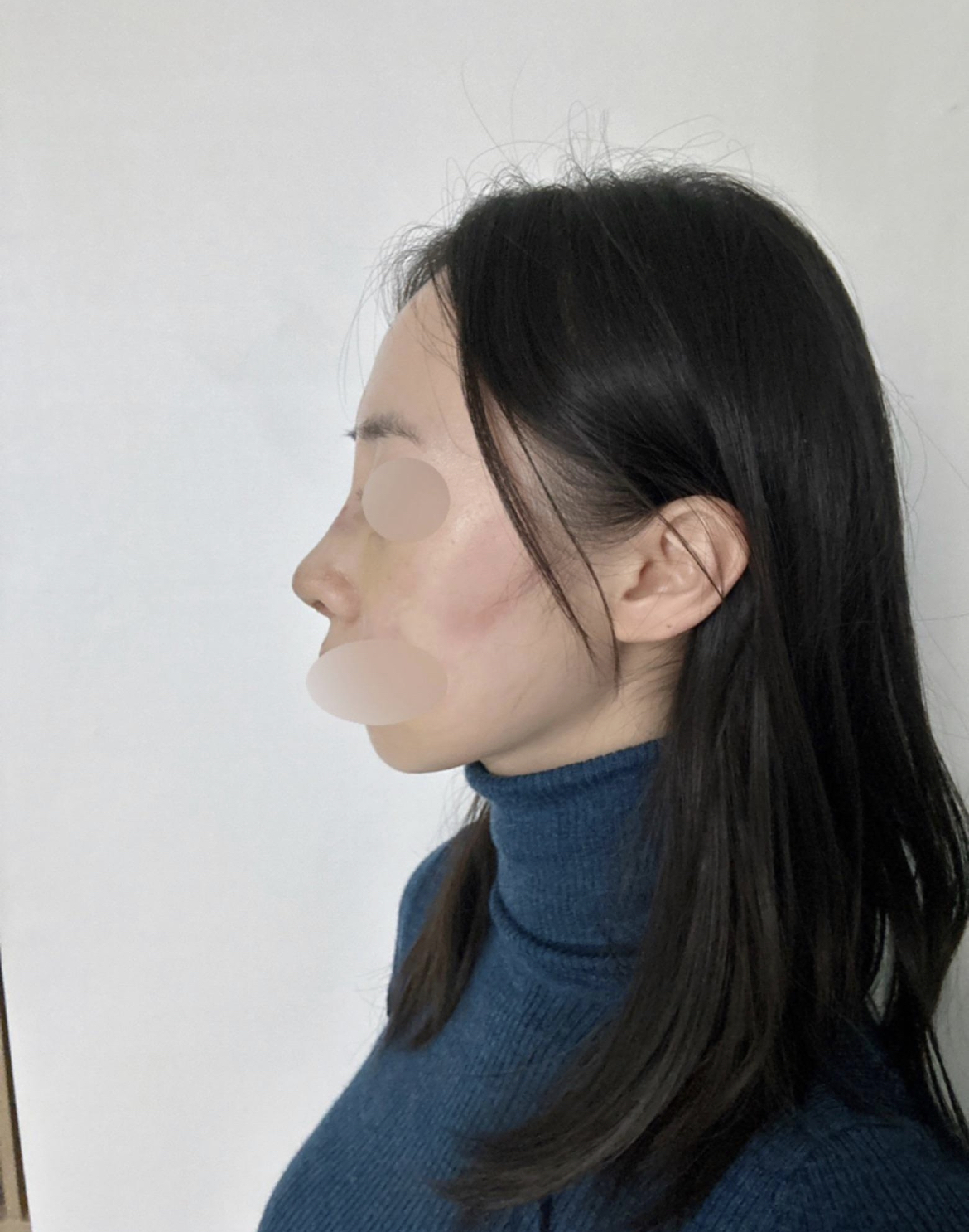 수술후기이미지