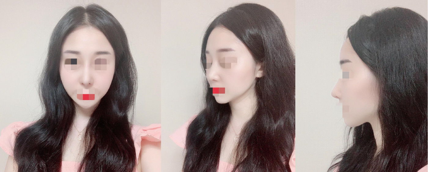 수술후기이미지