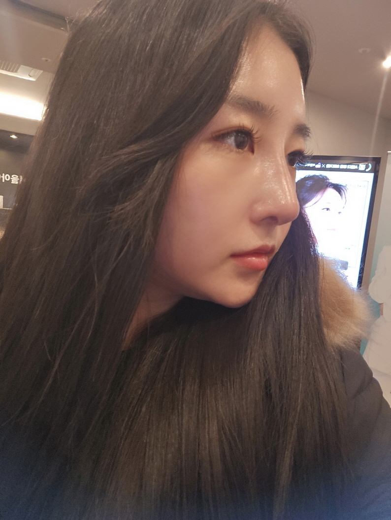 수술후기이미지