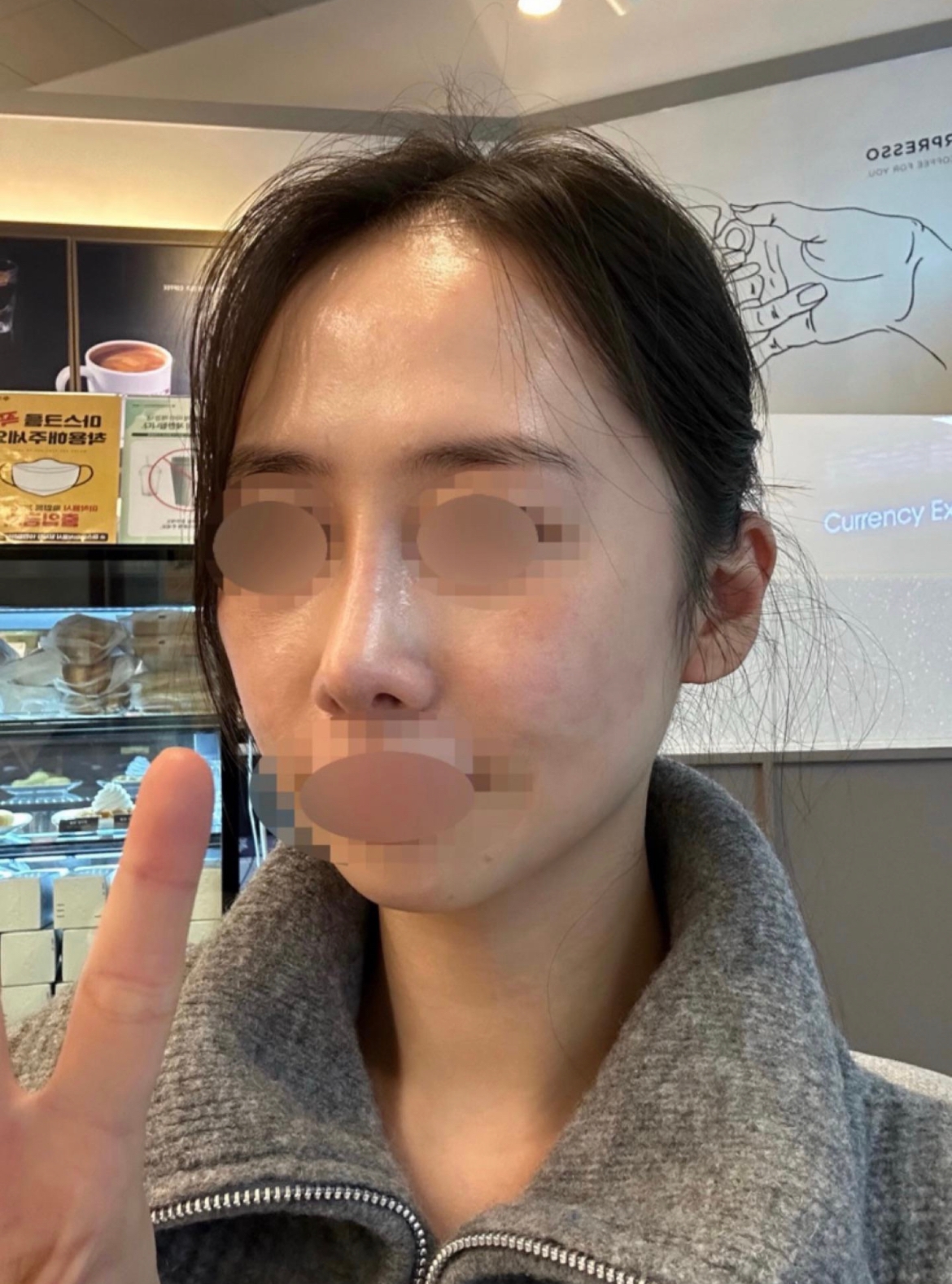 수술후기이미지