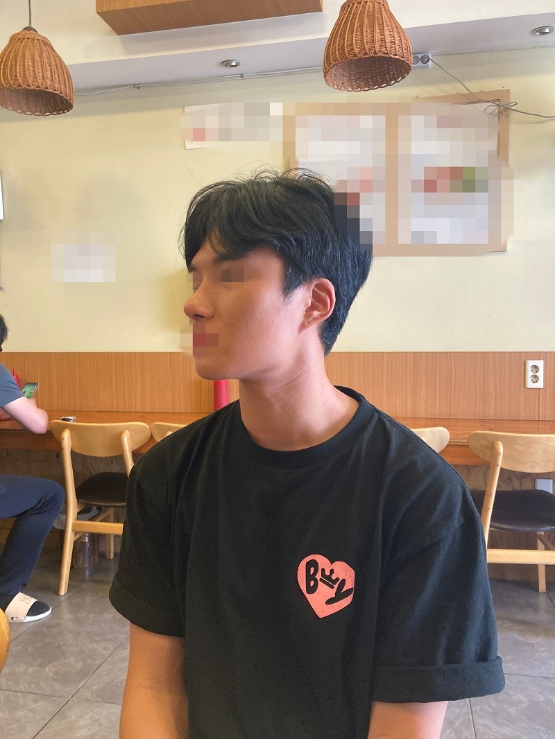 수술후기이미지