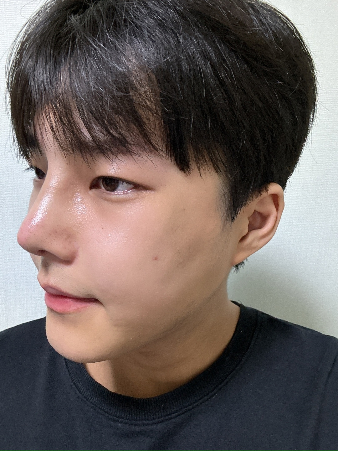 수술후기이미지