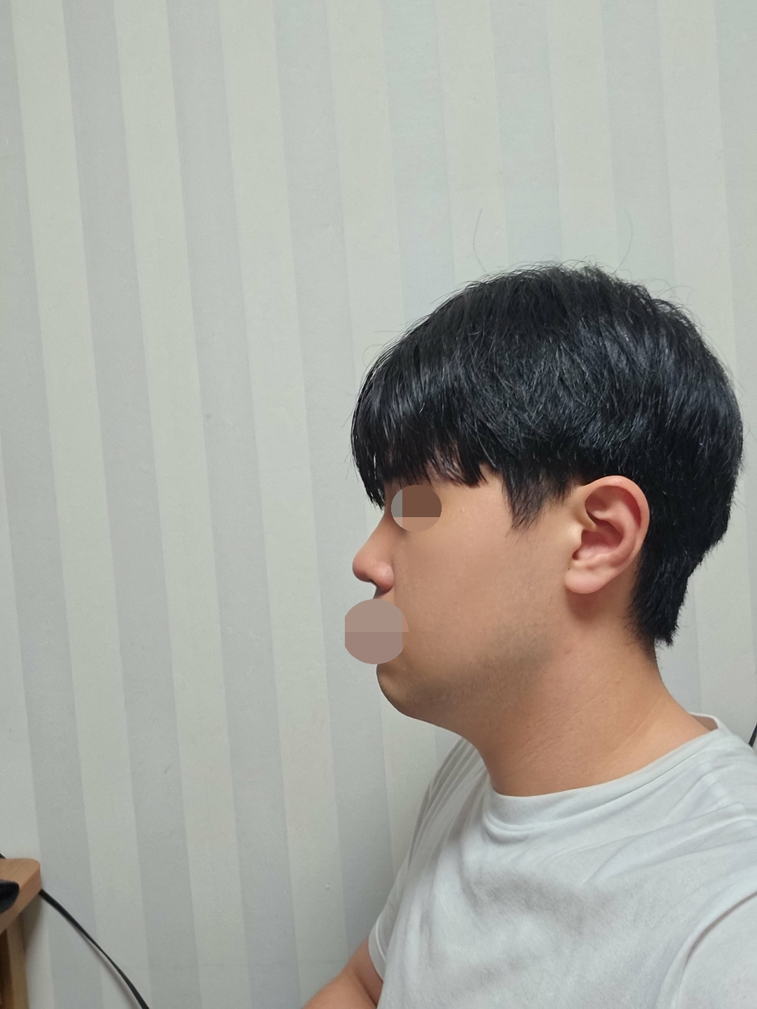 수술후기이미지