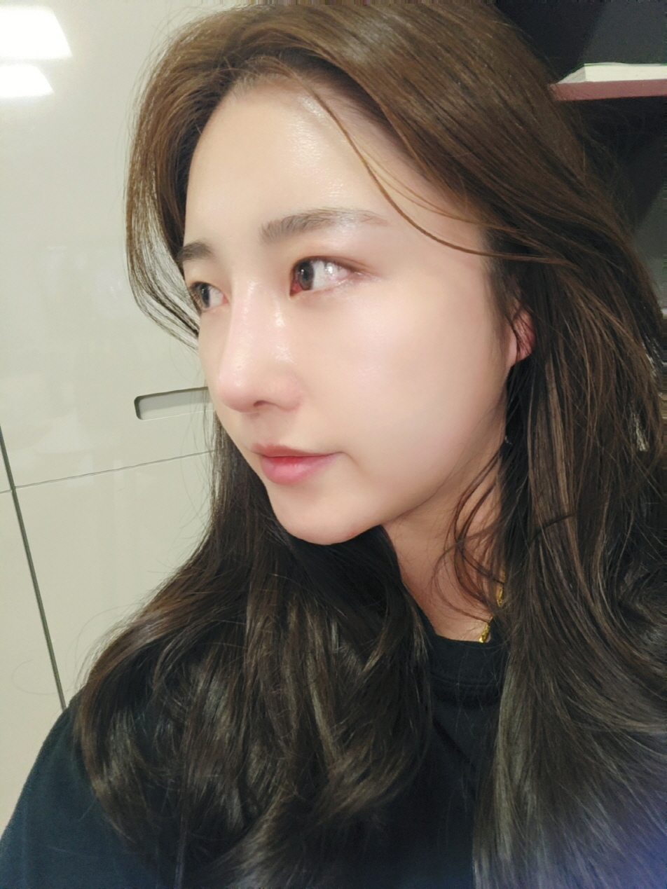 수술후기이미지