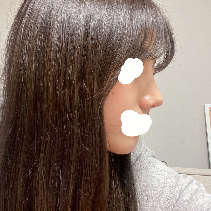 수술후기이미지