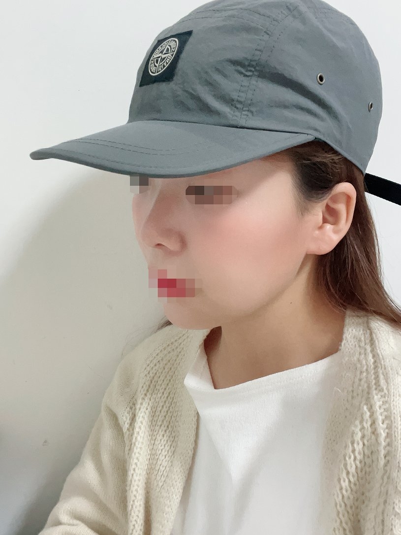 수술후기이미지