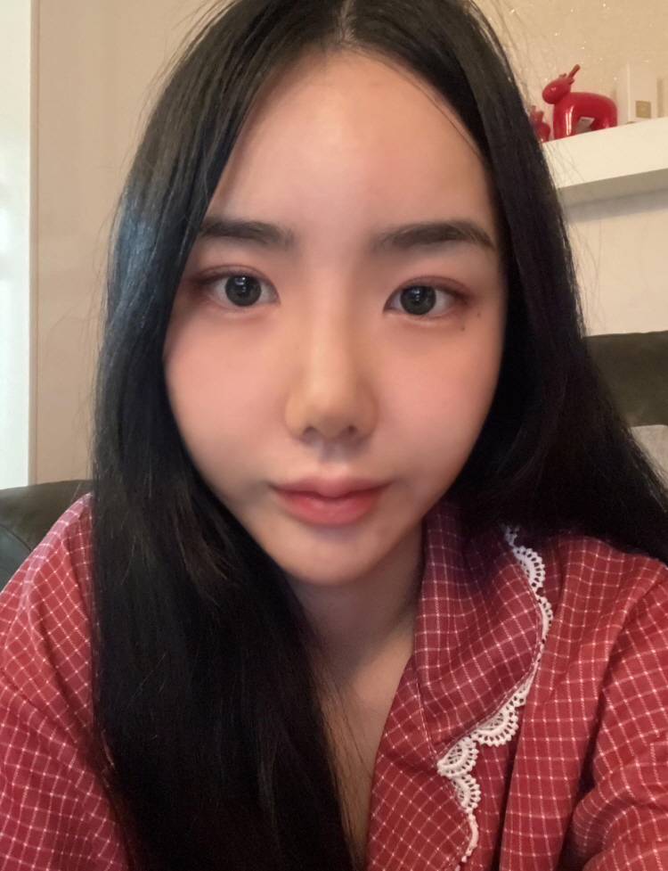 수술후기이미지