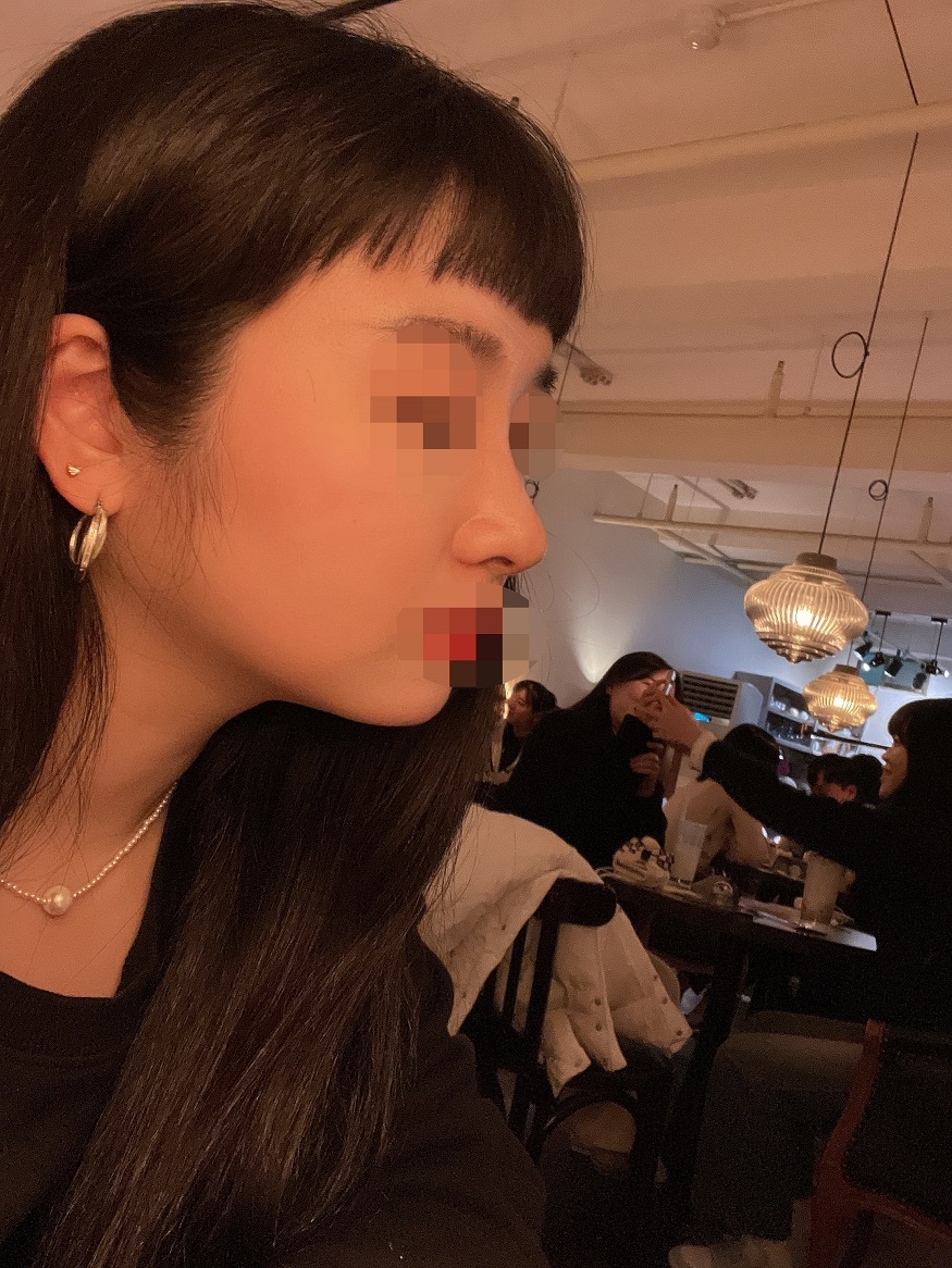 수술후기이미지