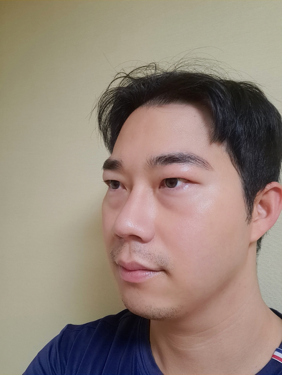 수술후기이미지