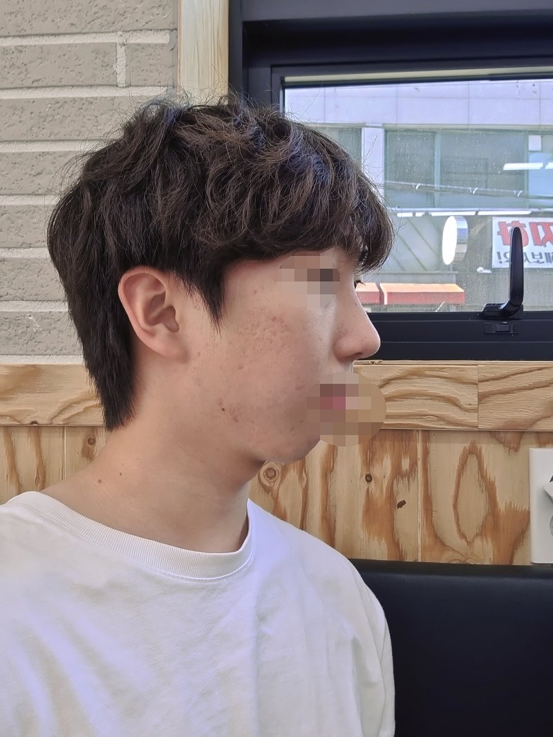 수술후기이미지