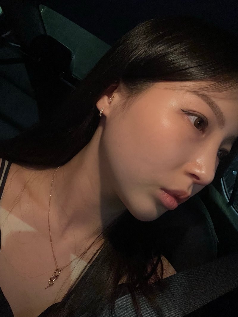 수술후기이미지