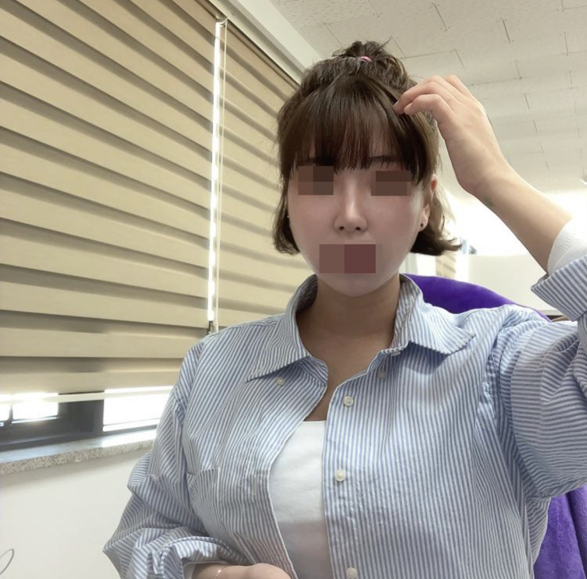 수술후기이미지