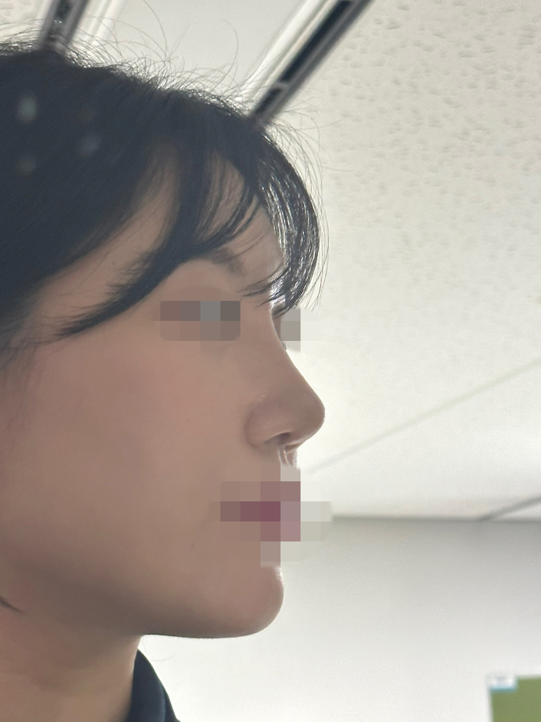 수술후기이미지