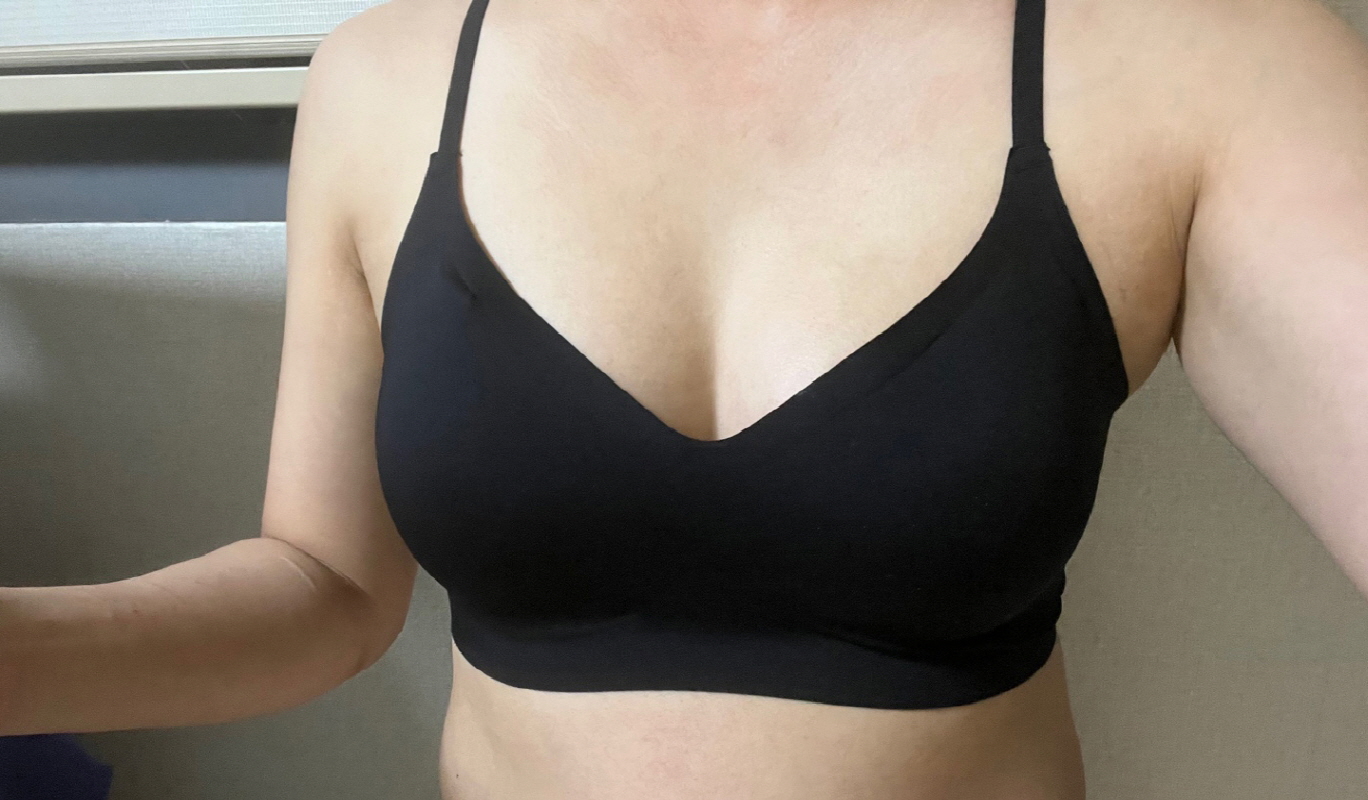 수술후기이미지