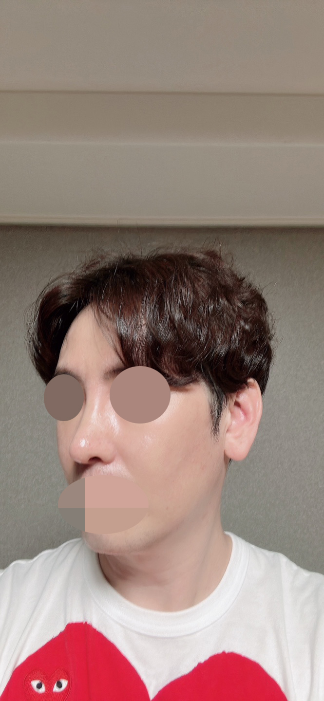 수술후기이미지