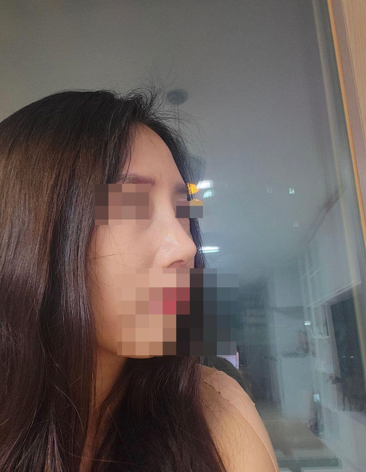 수술후기이미지