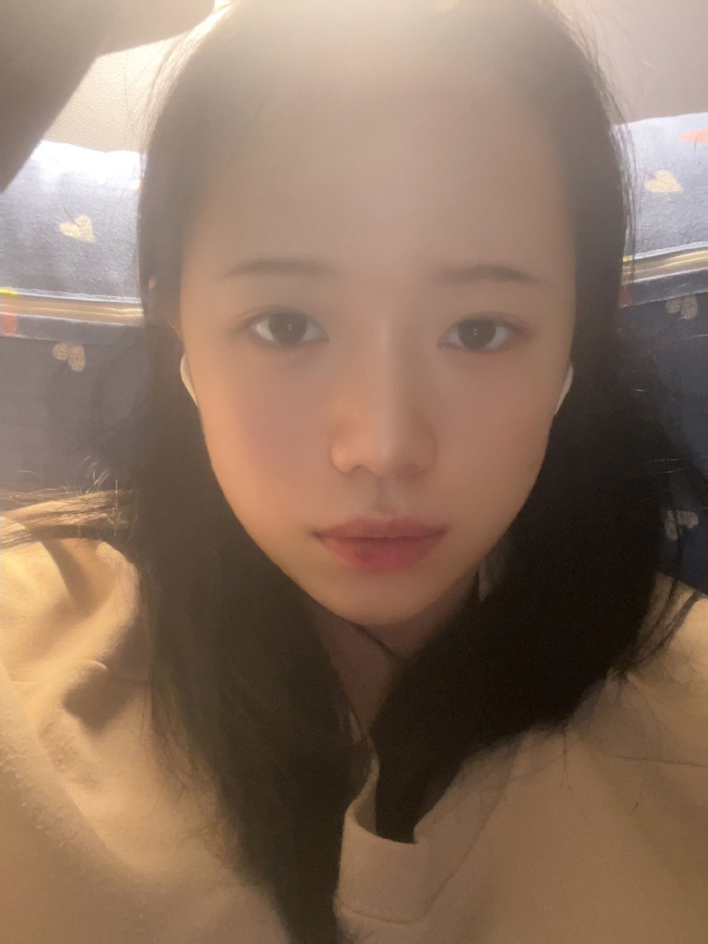 수술후기이미지