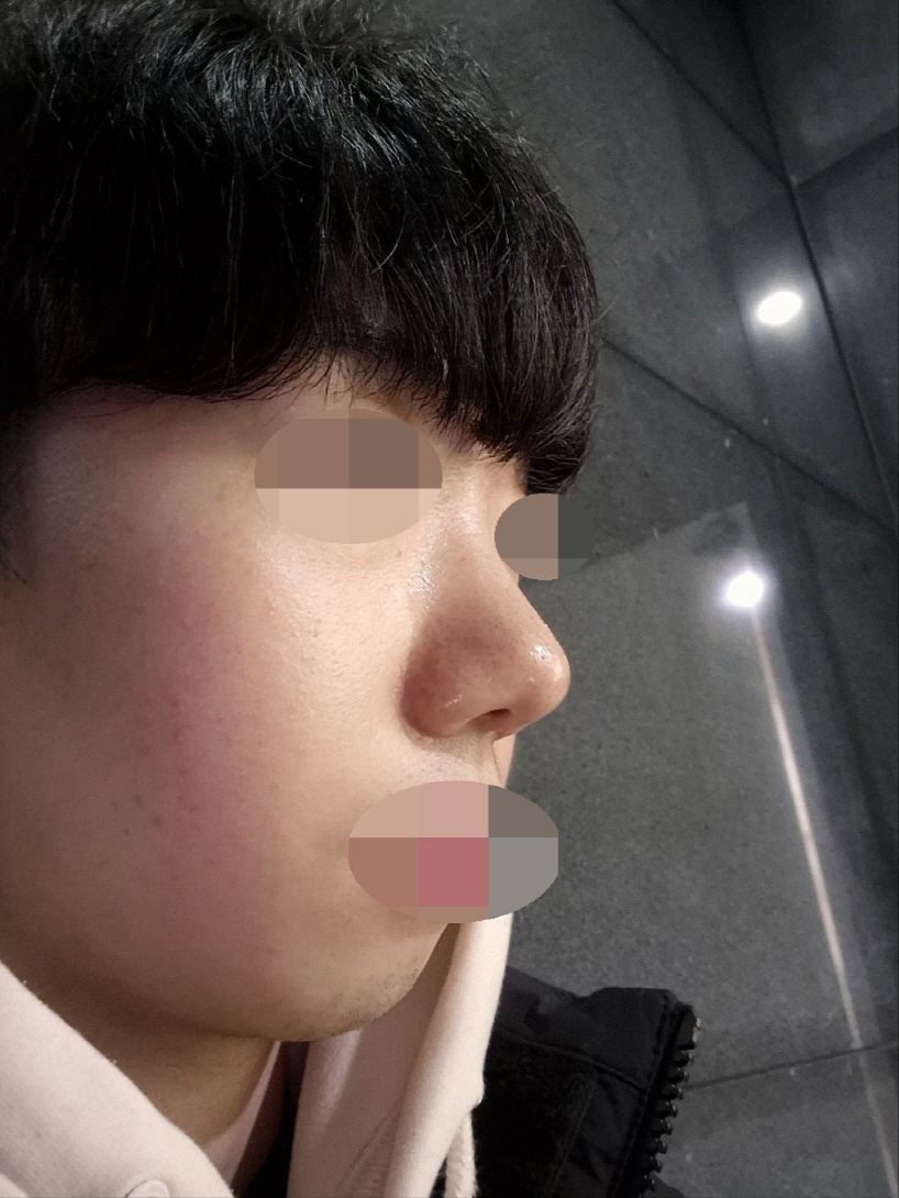 수술후기이미지