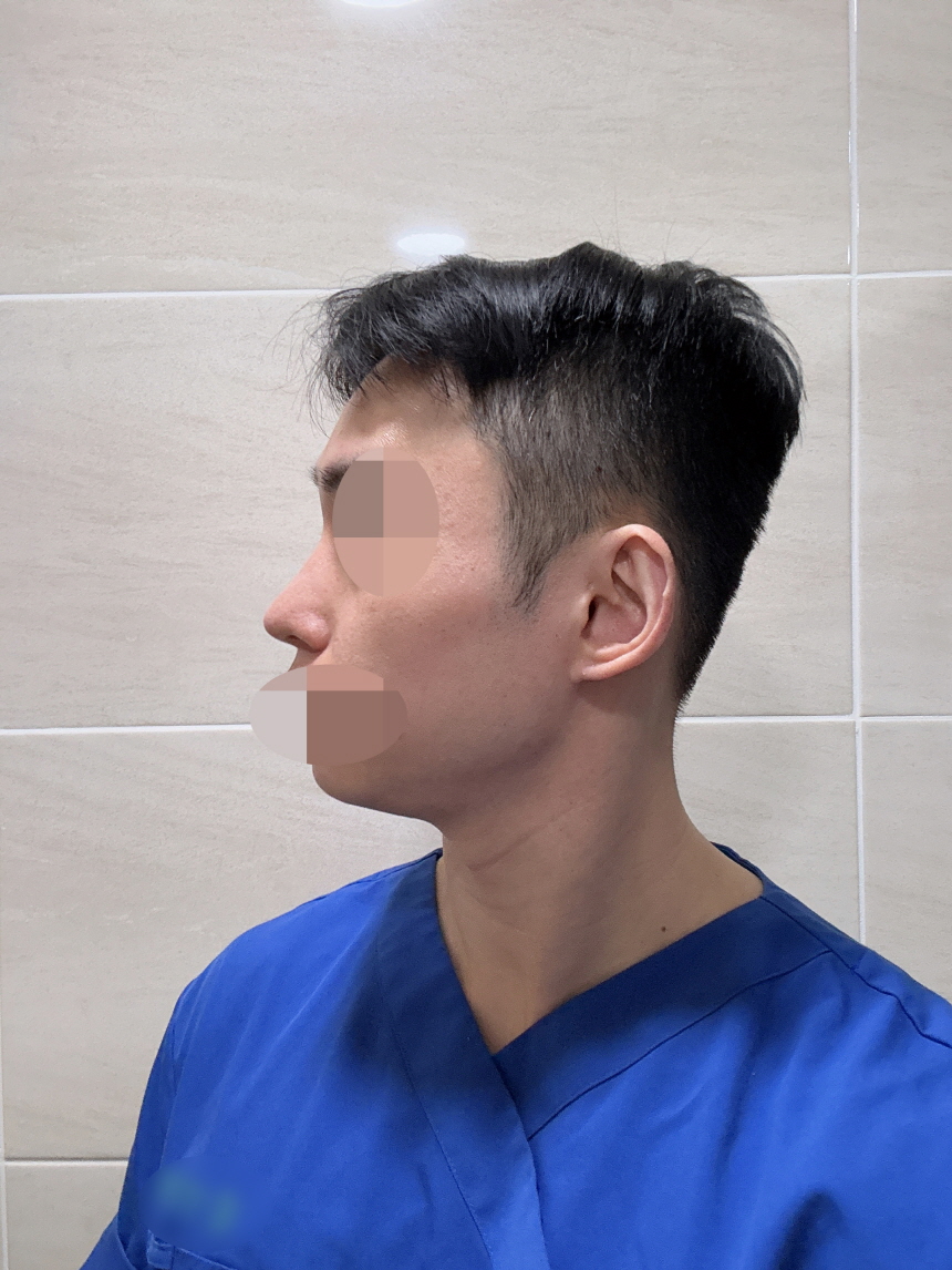 수술후기이미지