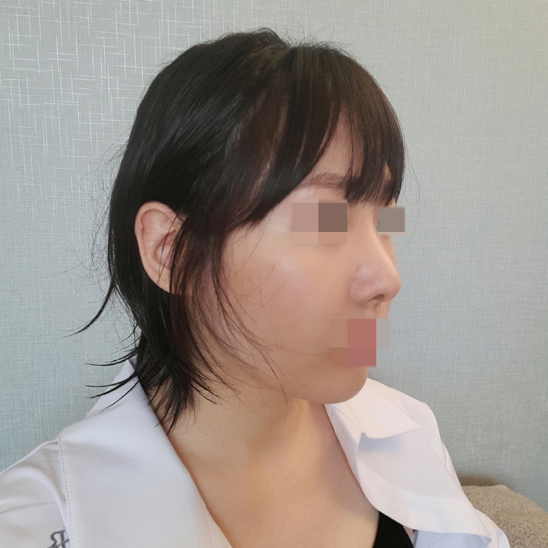 수술후기이미지