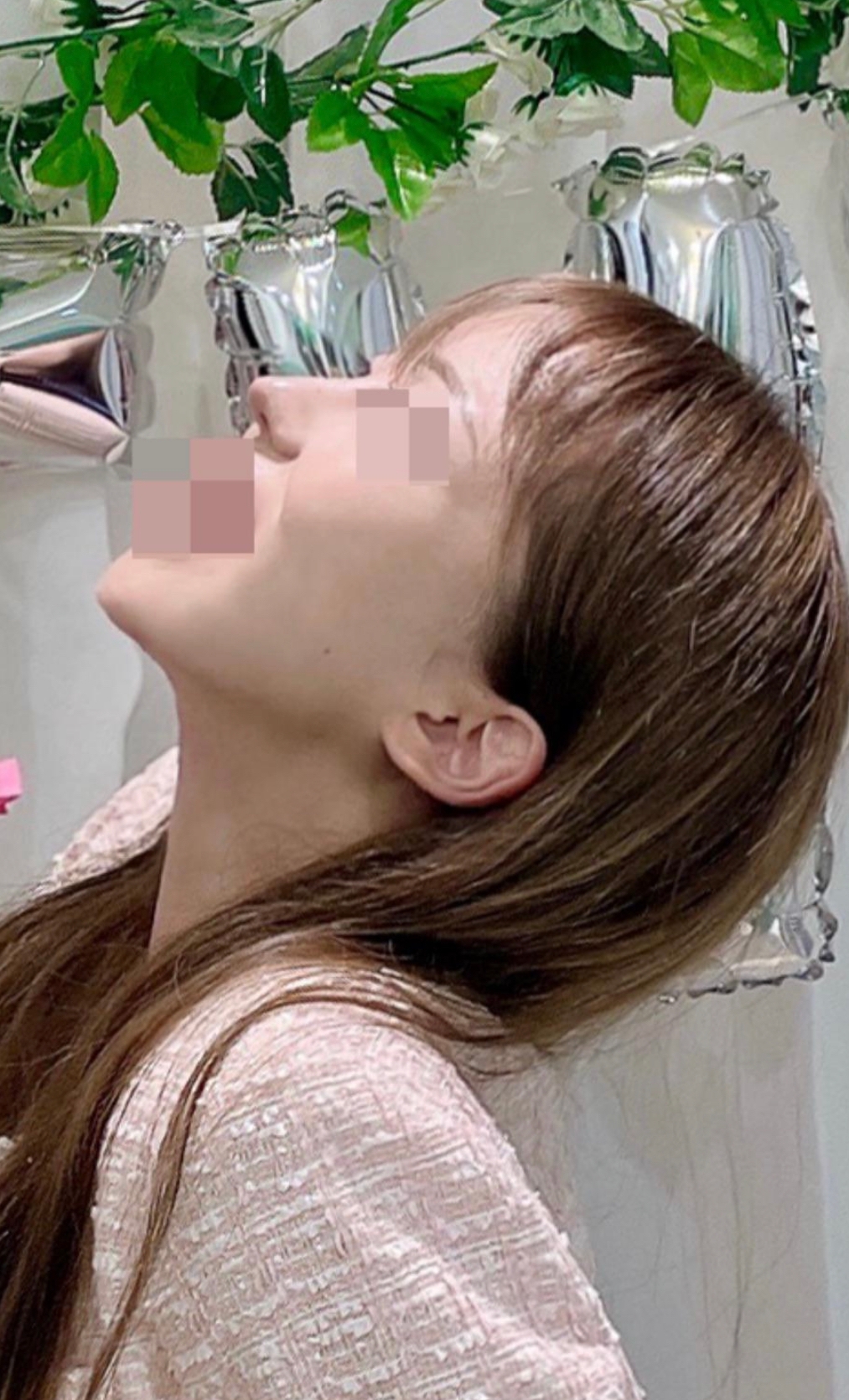 수술후기이미지