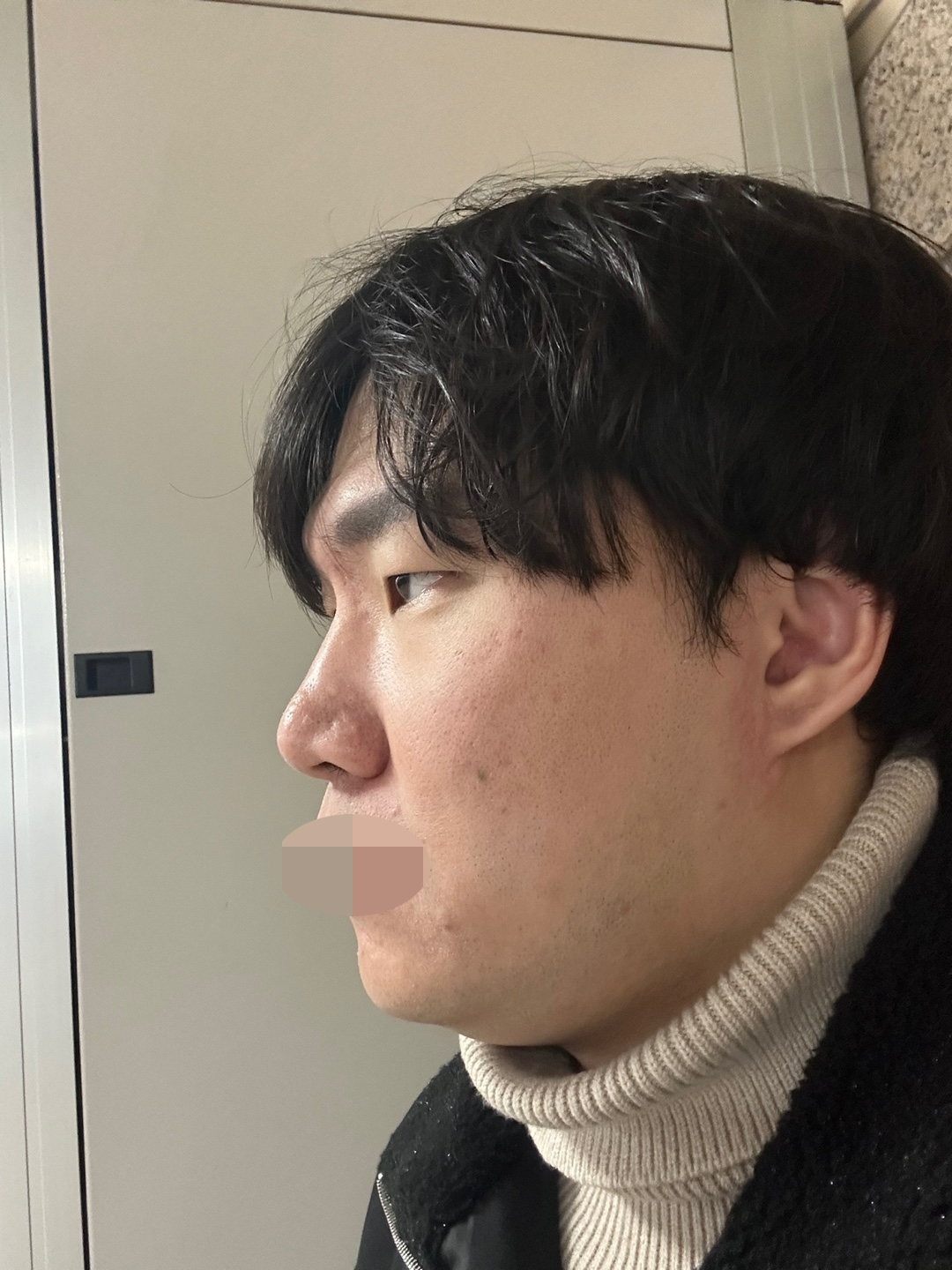 수술후기이미지