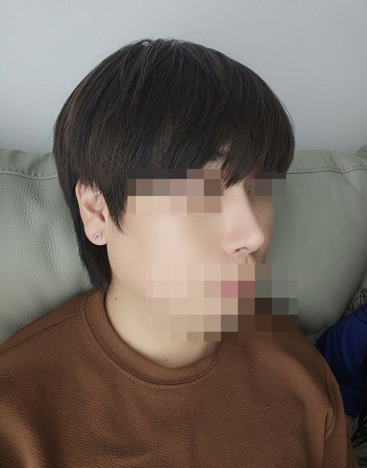 수술후기이미지