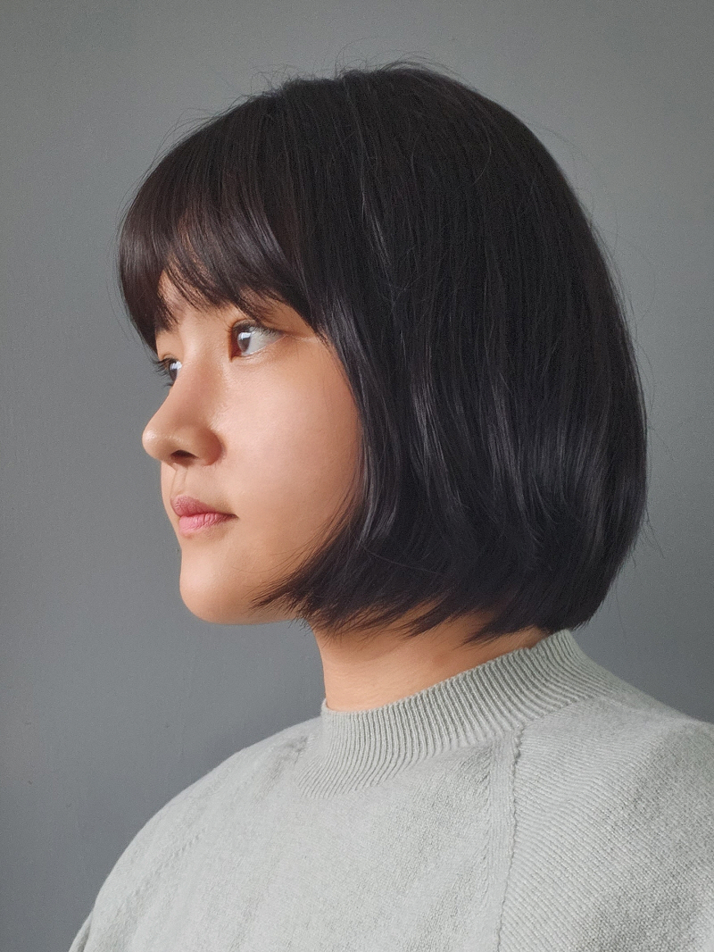 수술후기이미지