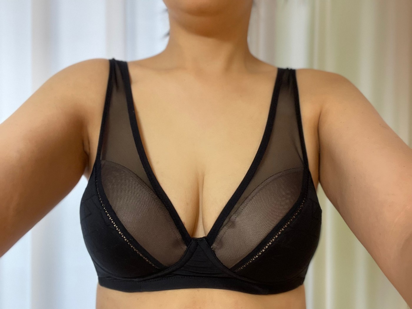 수술후기이미지