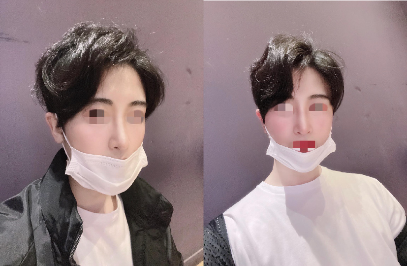 수술후기이미지