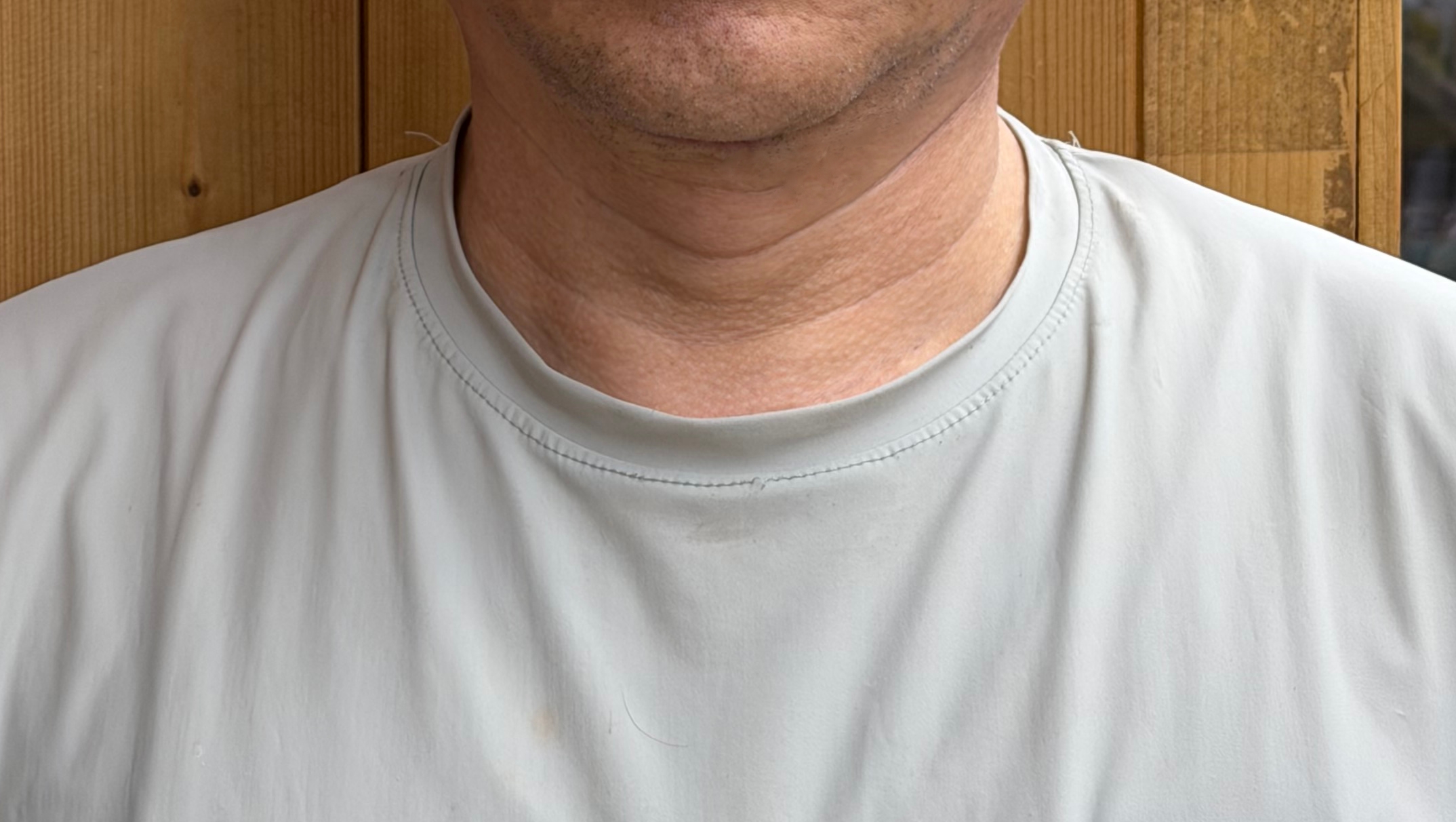 수술후기이미지