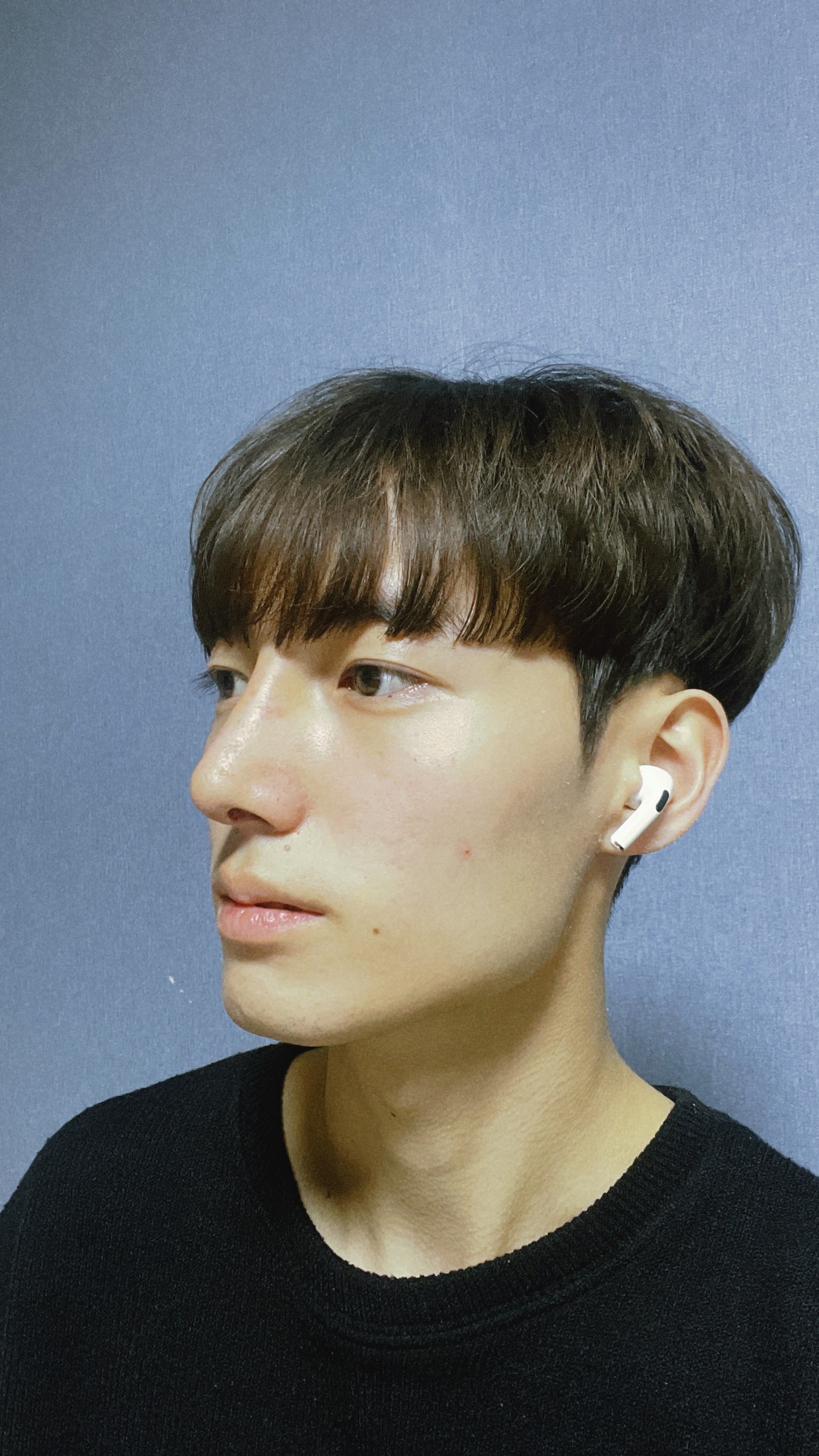 수술후기이미지