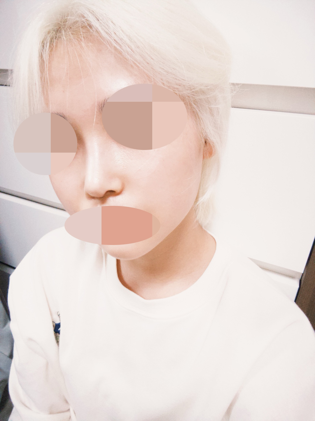 수술후기이미지