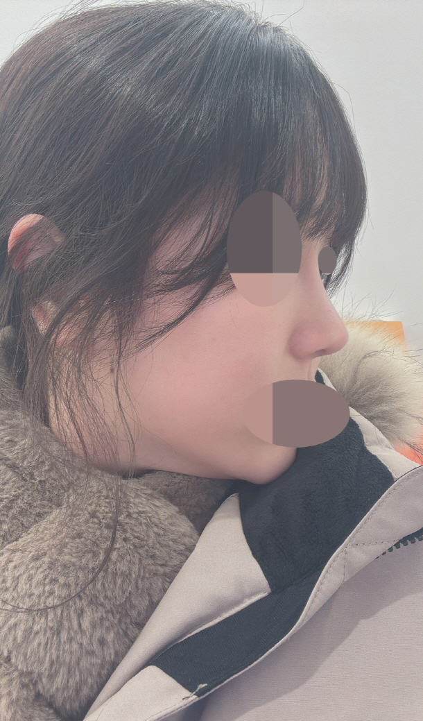 수술후기이미지