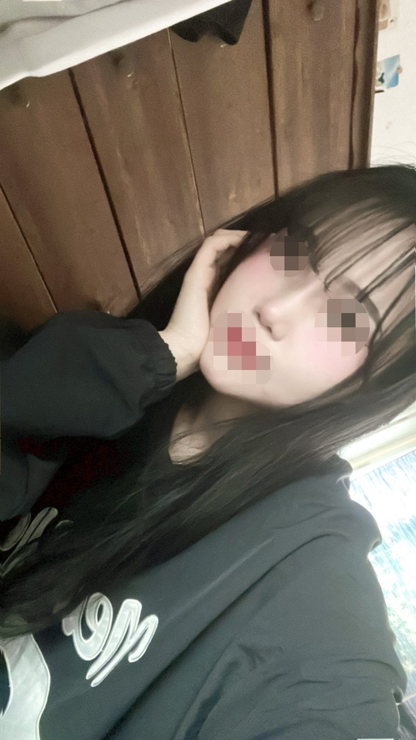 수술후기이미지