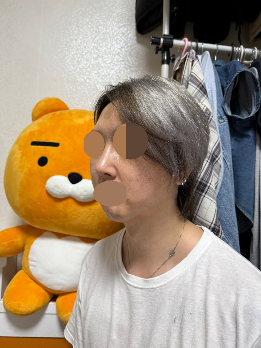 수술후기이미지