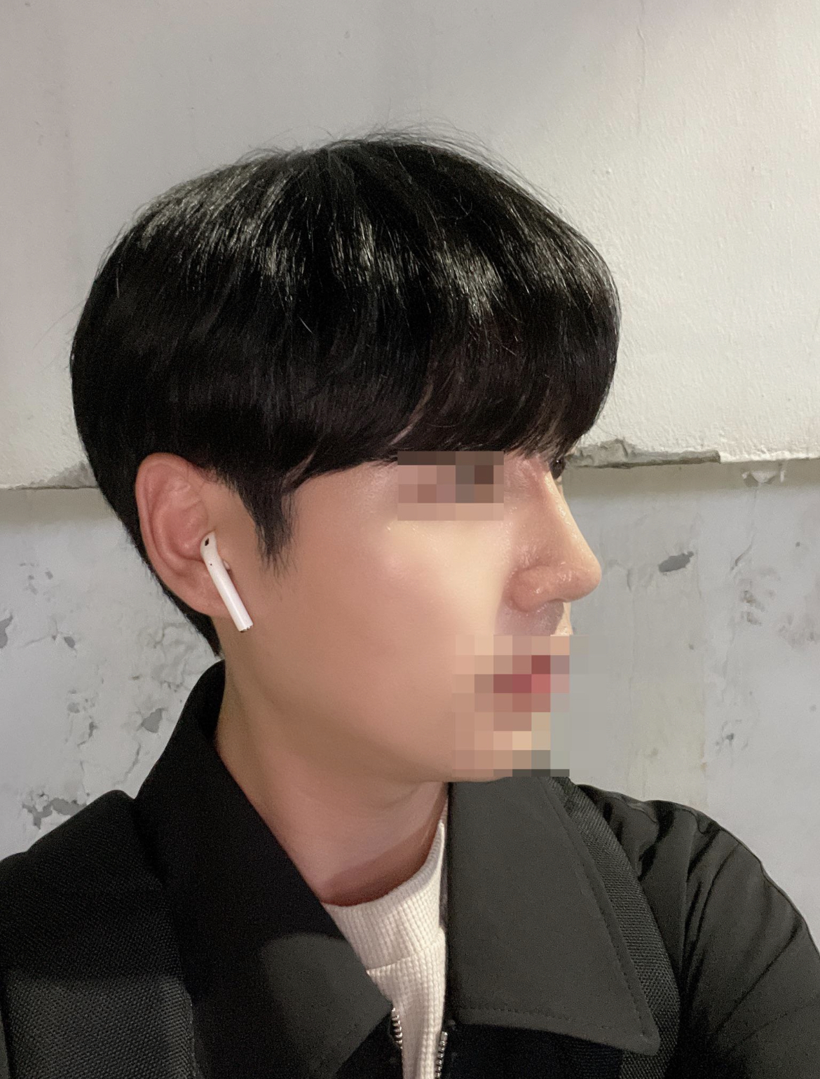 수술후기이미지