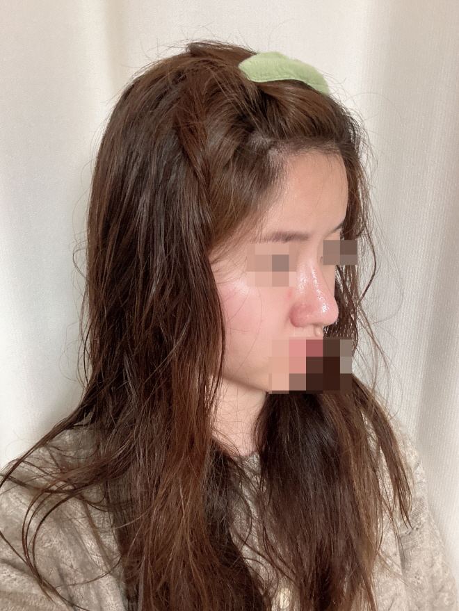 수술후기이미지