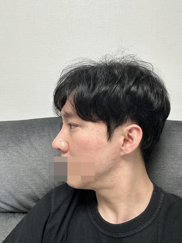 수술후기이미지